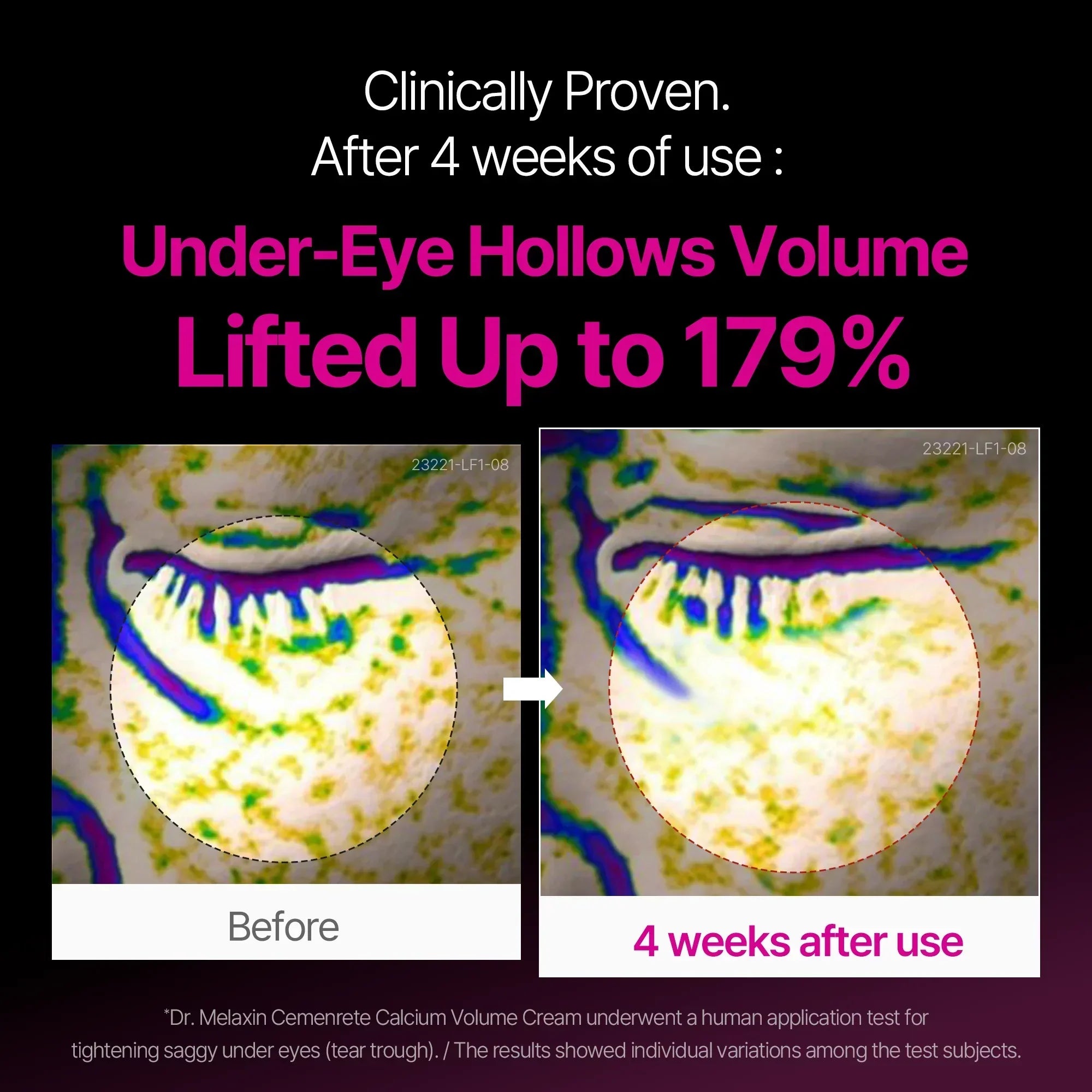 Cemenrete Calcium Intense Ampoule